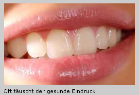 Vorsorge_Zaehne