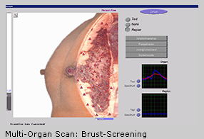 brust-screening_ellen_kruase