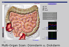 multi_organ_scan_Duenndarm_ellen_krause